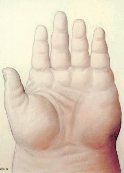Mano by Fernando Botero